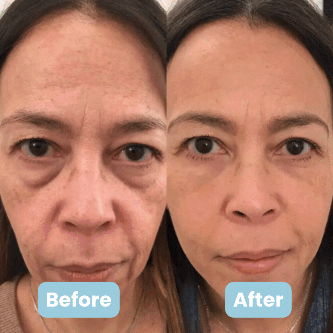 3-in-1 LED Facial Sculptor